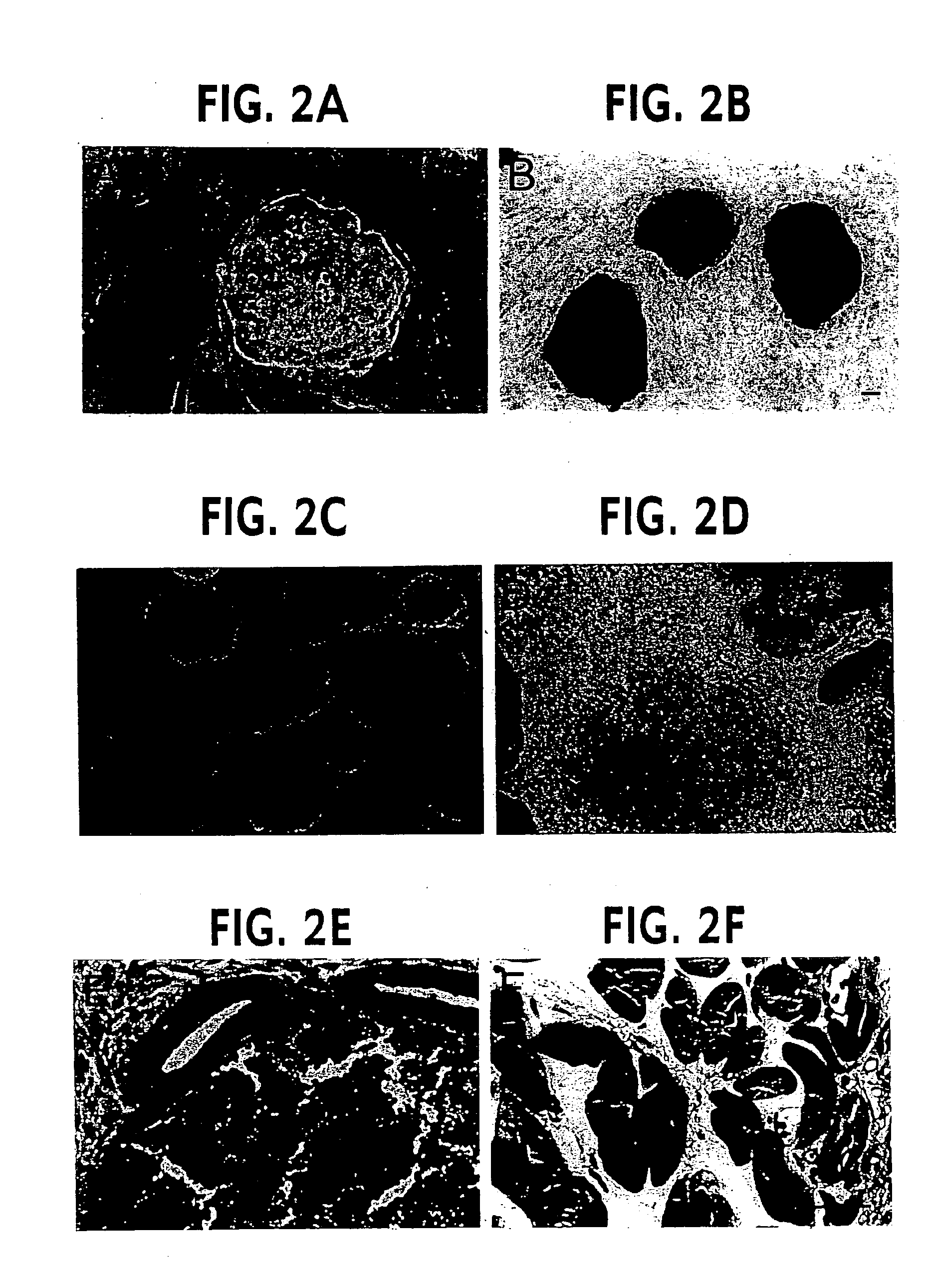 Methods for assaying gene imprinting and methylated CpG islands