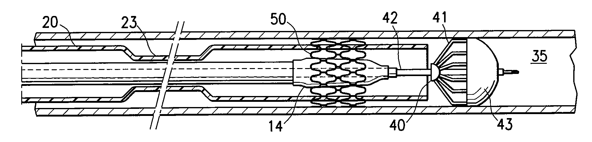 Highly trackable balloon catheter system and method for collapsing an expanded medical device