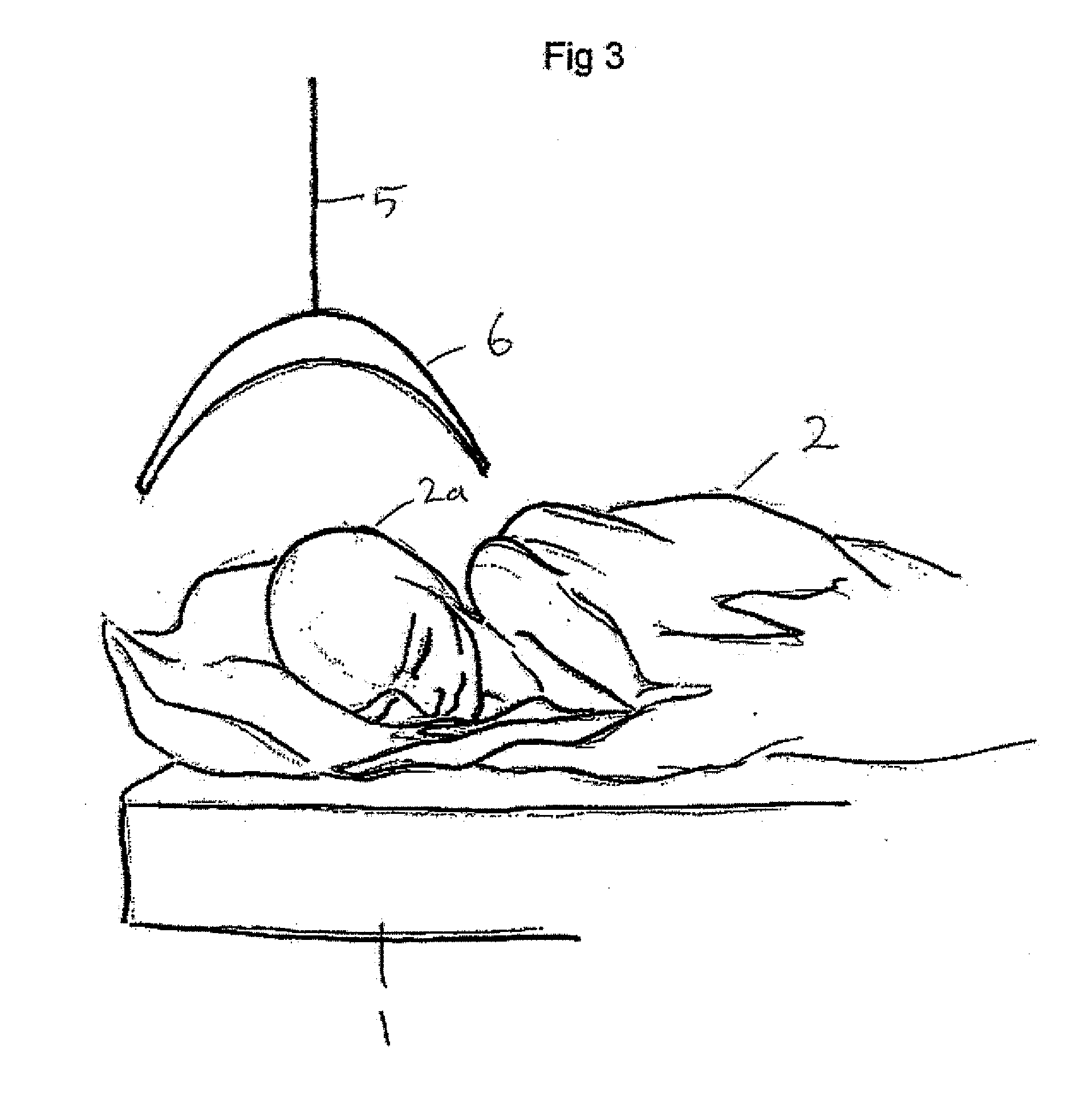 Treatment or Therapy Apparatus