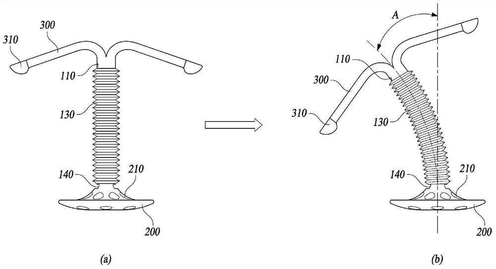 Cervical adhesion prevention device