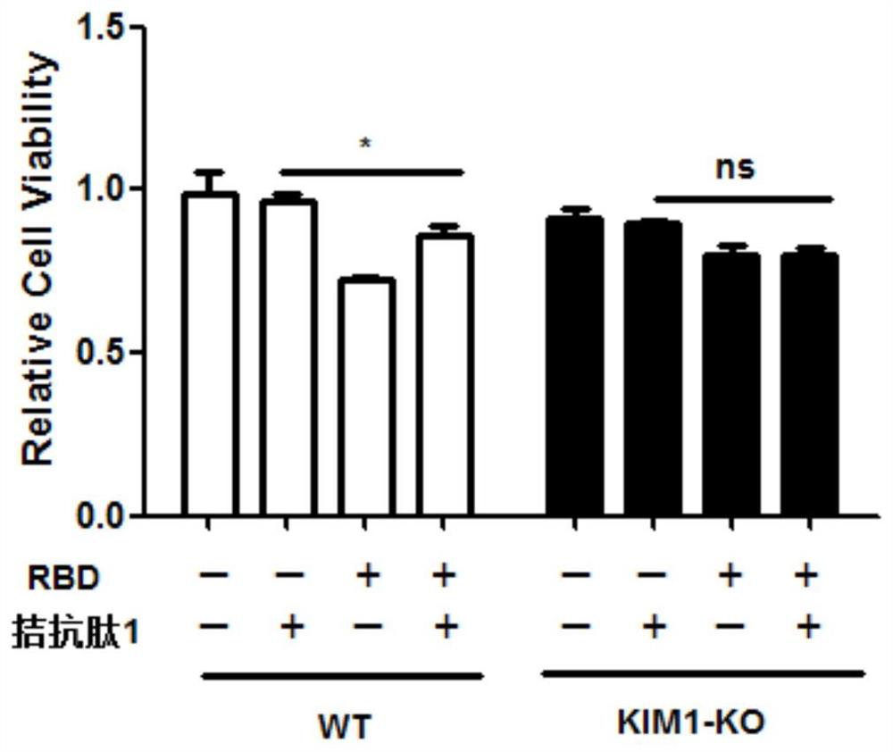 Antagonistic polypeptide and its application in the preparation of anti-new coronavirus drugs