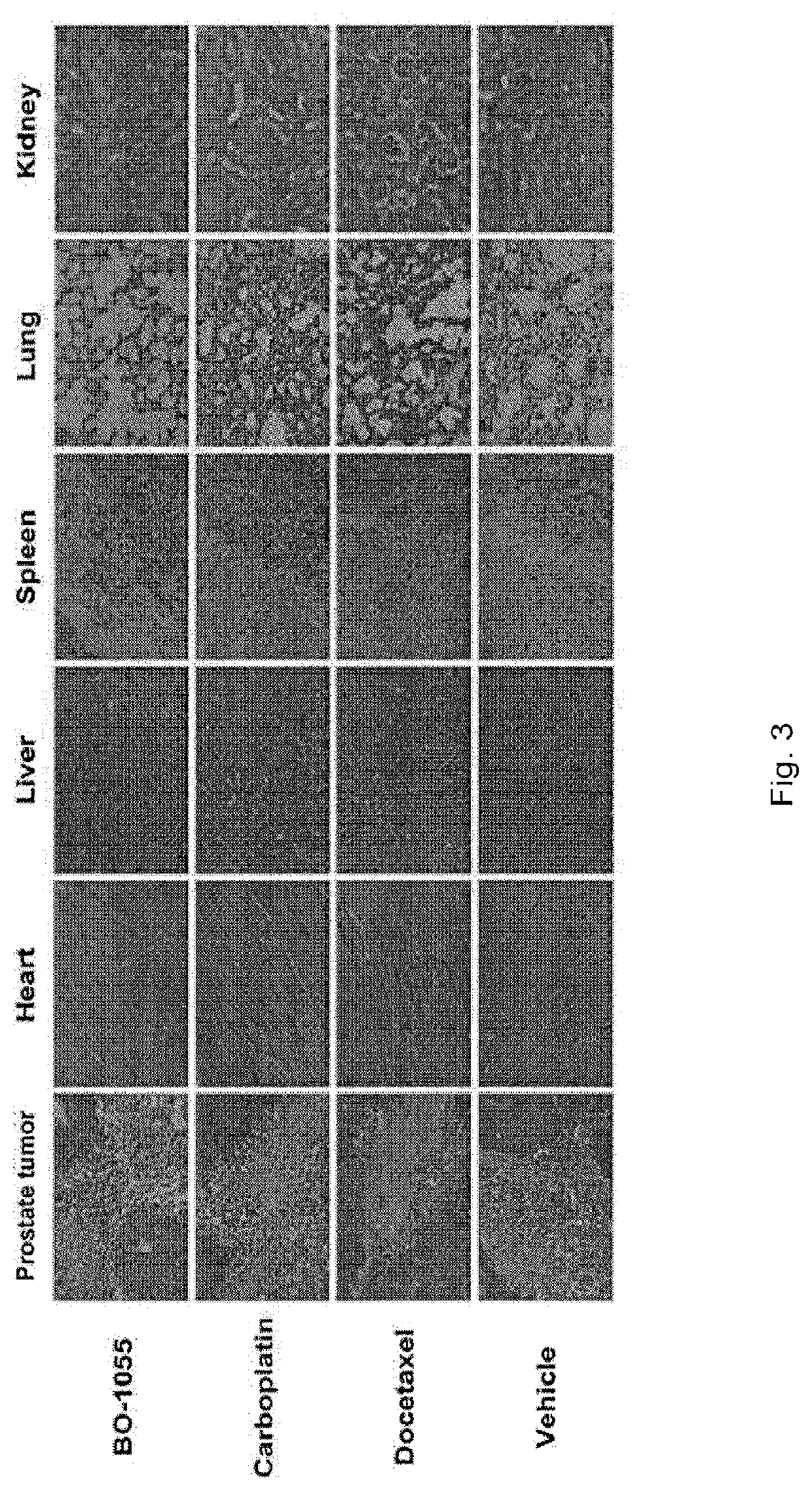 Use of ureidomustine (BO-1055) in cancer treatment