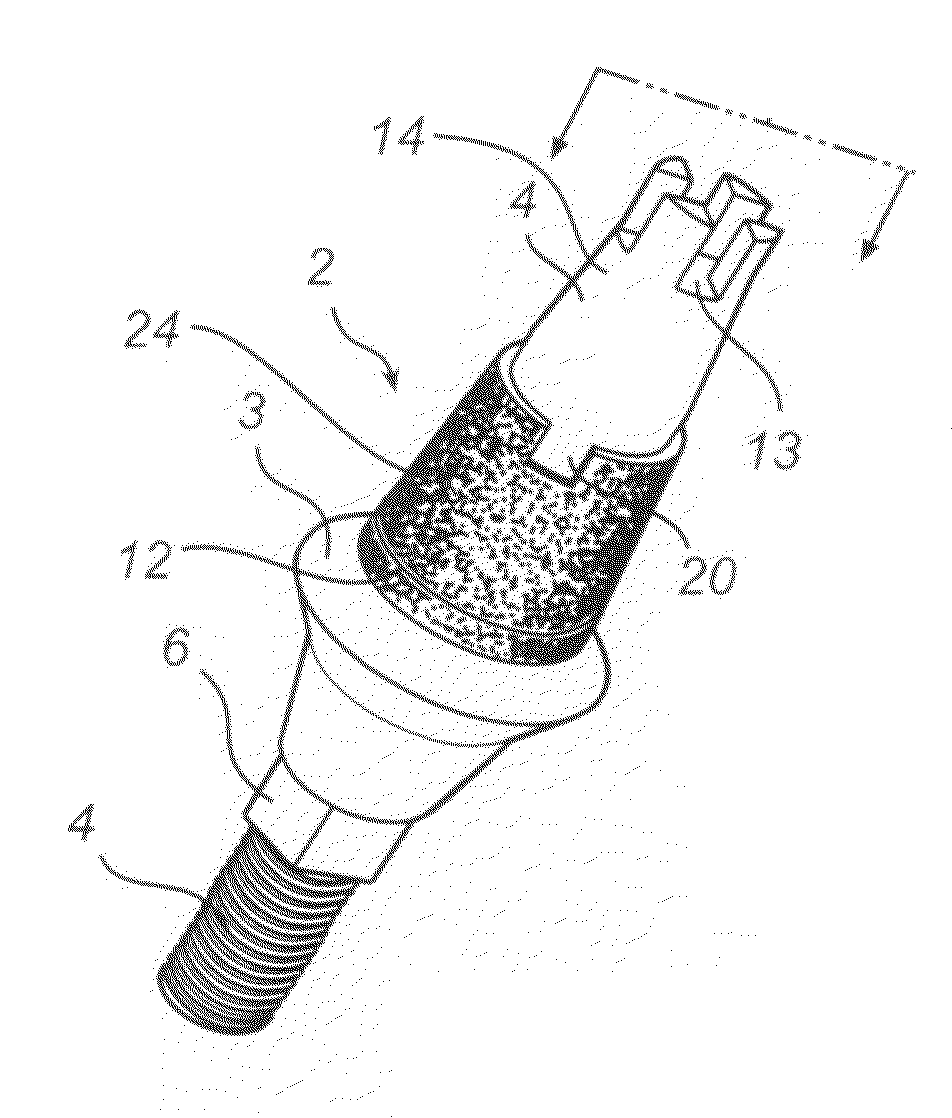 Dental implant, abutment structure and method for implanting a dental implant