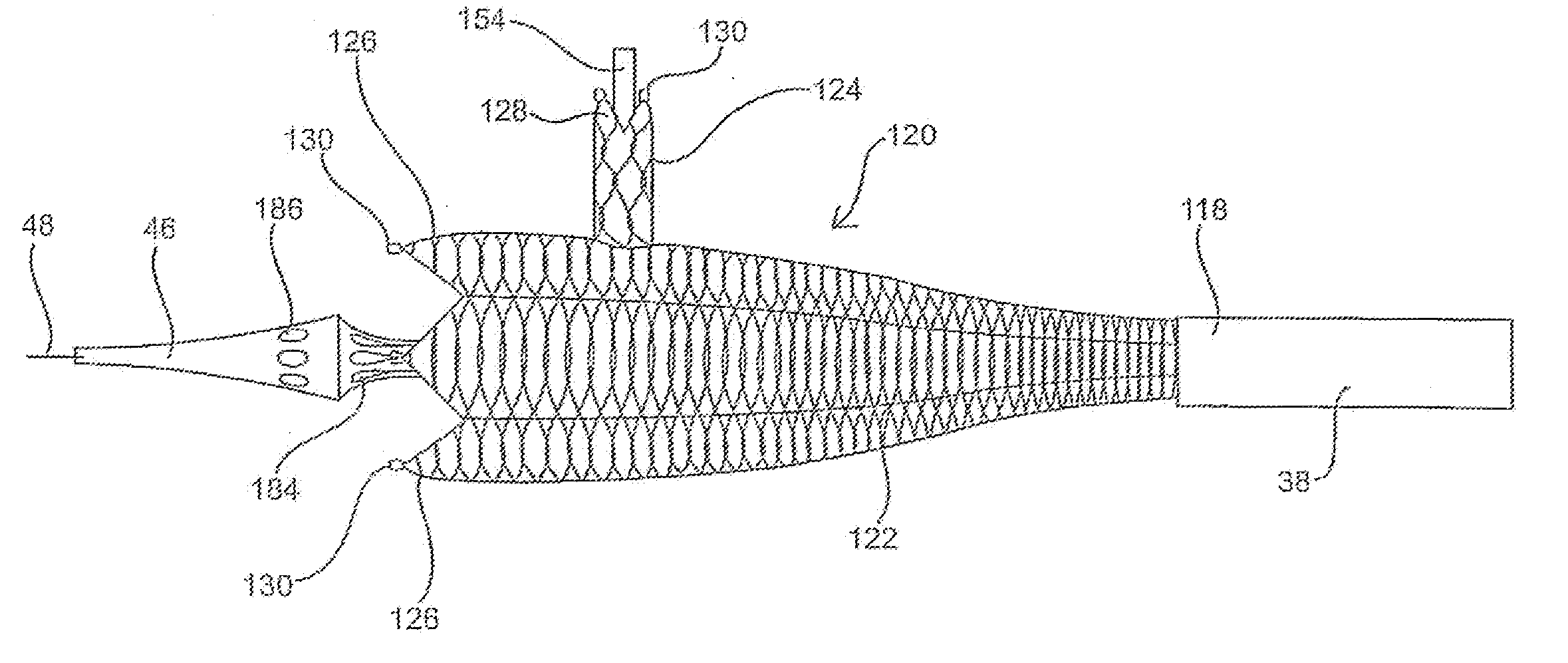 Apparatus and method for deploying an implantable device within the body
