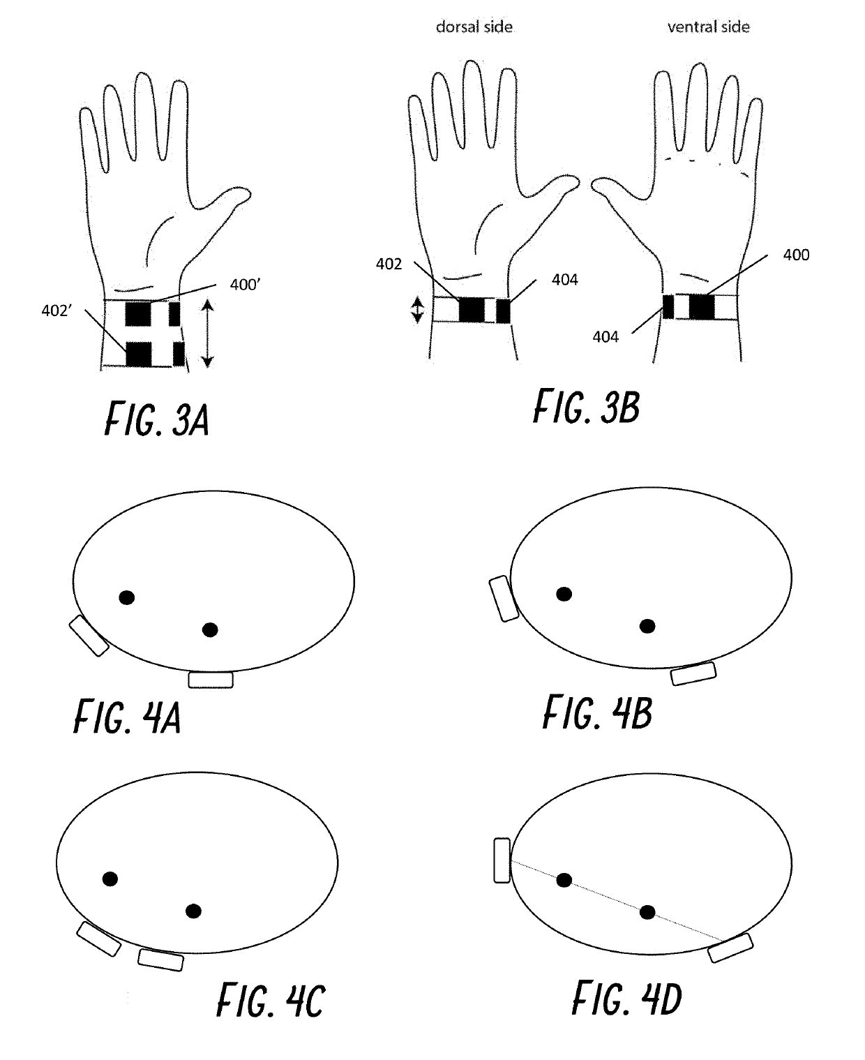 Dry electrodes for transcutaneous nerve stimulation