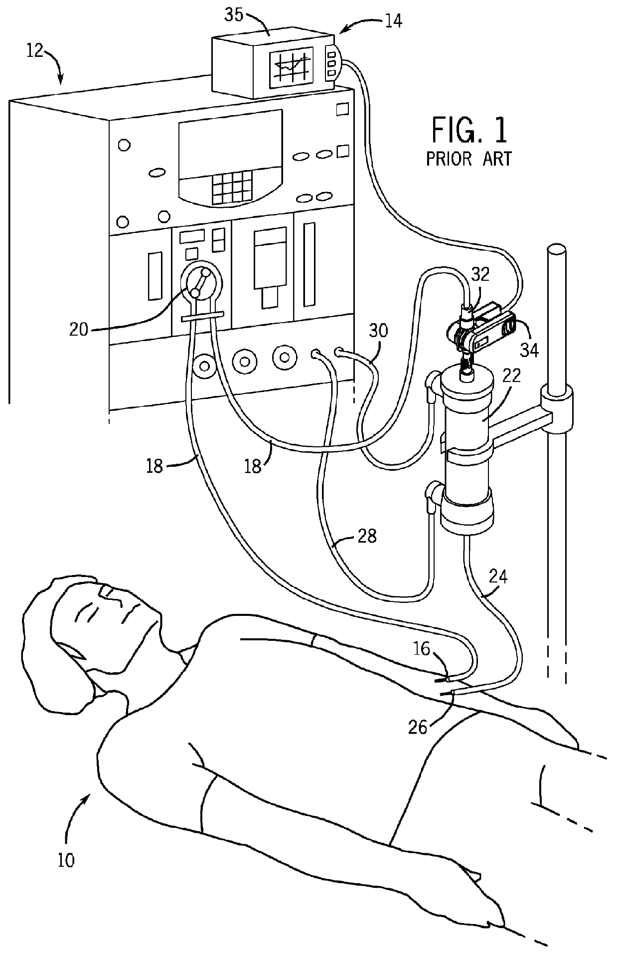 Shrouded Sensor Clip Assembly and Blood Chamber for an Optical Blood Monitoring System