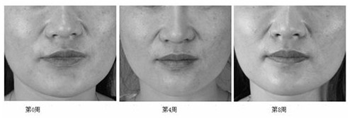 Skin care composition with pore refining effect
