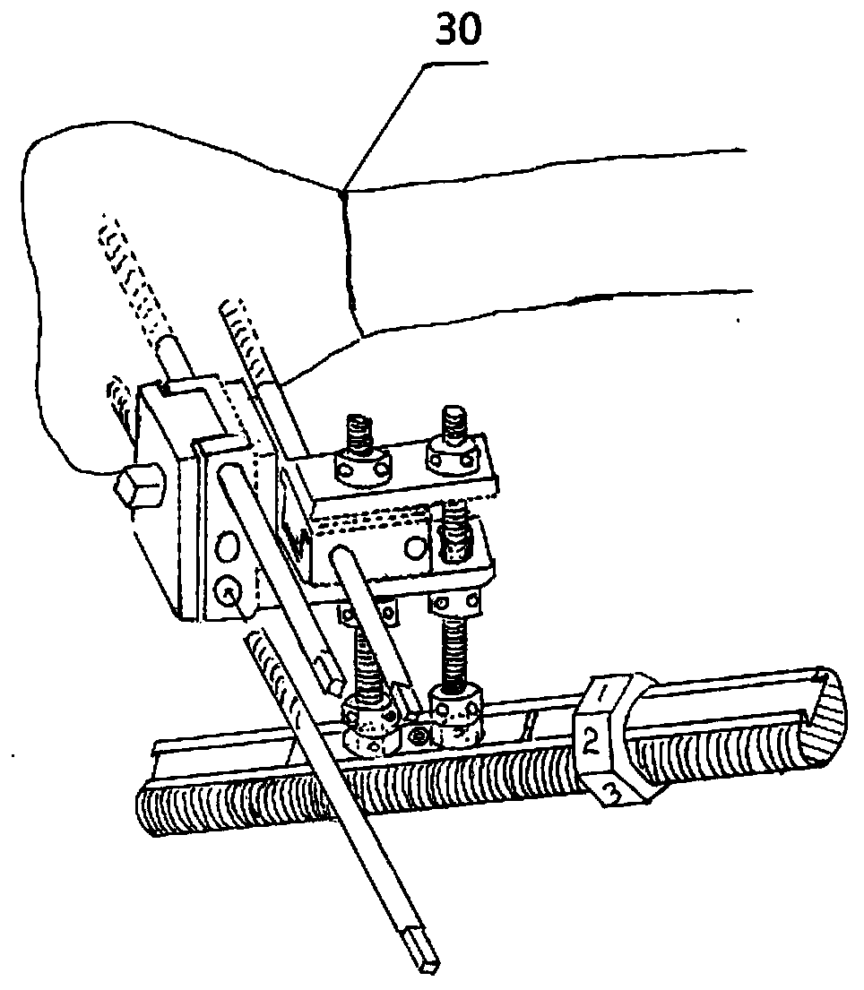 Mechanical double-upper-limb dynamic comprehensive restitution multi-section bone malformation external fixing support