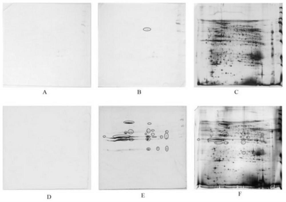 Babesia voles 2d97 antigen protein and its application