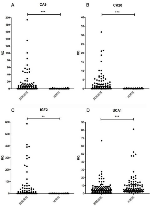 Application of a tumor marker ca9 and uca1 in the preparation of a kit for non-invasive detection of the probability of bladder cancer