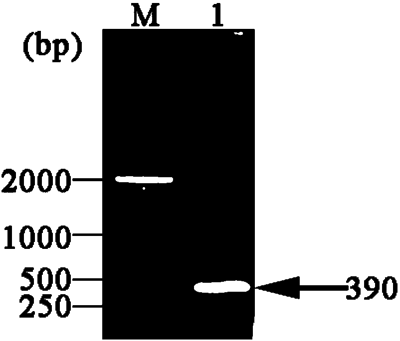 Trigenic coexpression vector for synthesizing DL-alanine and application