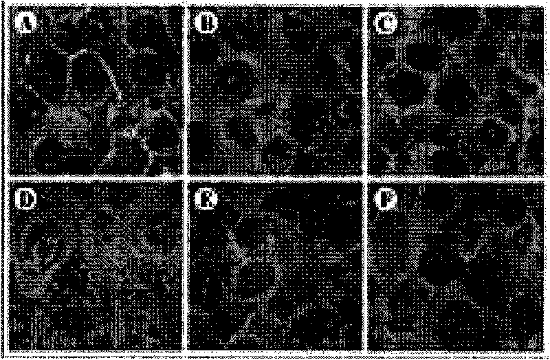 Application of composite of sweet wormwood herb and turtle shell in preparing antitumor medicine