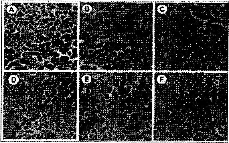 Application of composite of sweet wormwood herb and turtle shell in preparing antitumor medicine