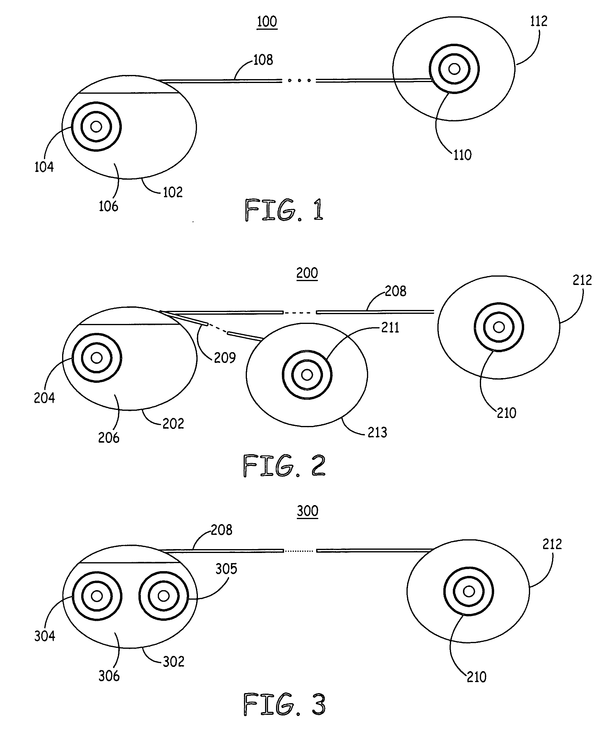 Method and apparatus for arrhythmia detection in a medical device