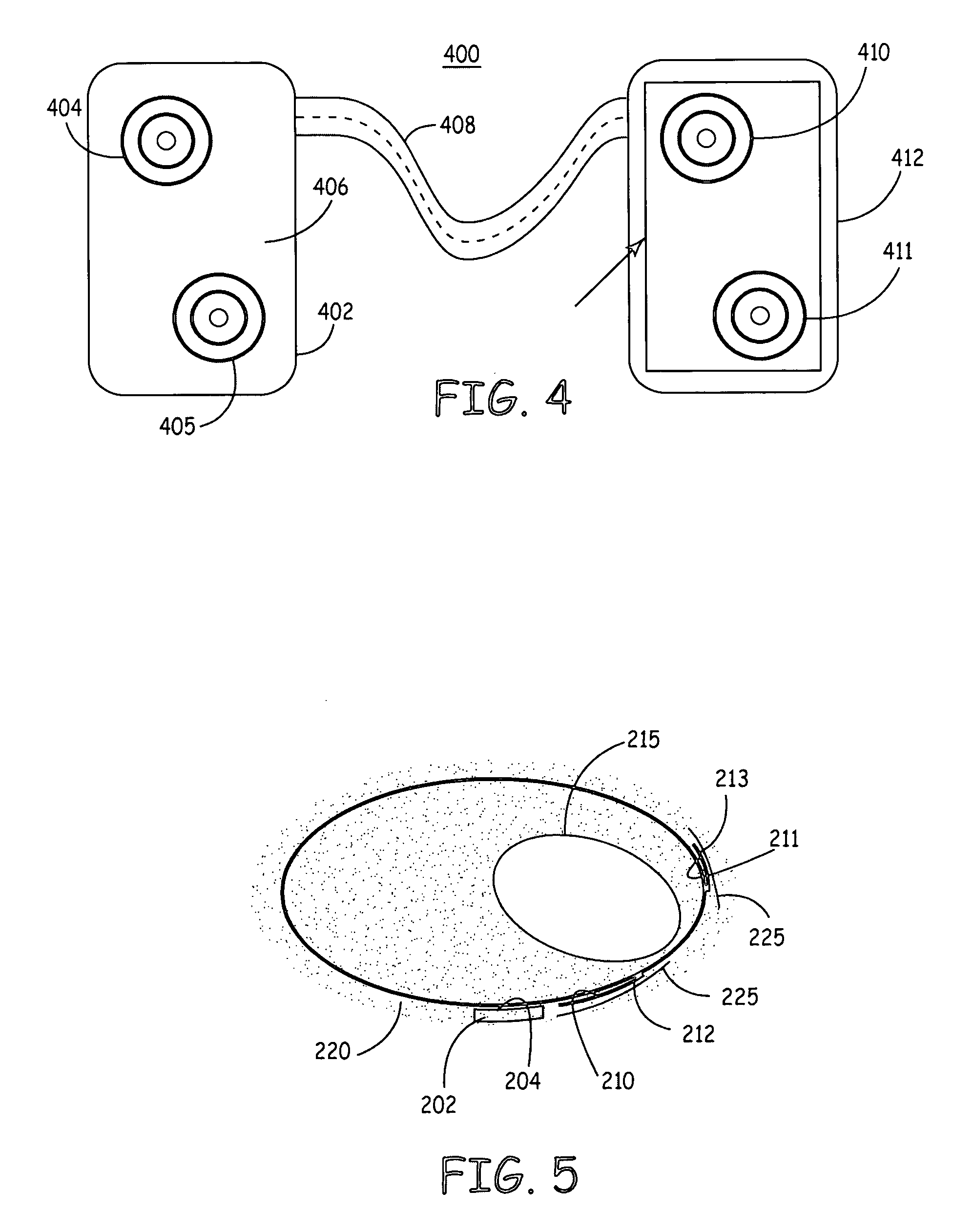 Method and apparatus for arrhythmia detection in a medical device