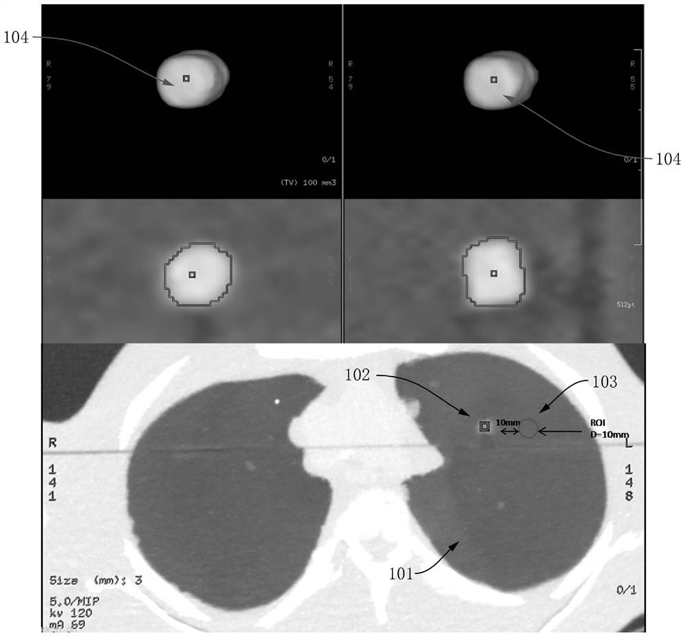 A Method for Optimizing the Parameters of Chest Low-dose CT Scanning