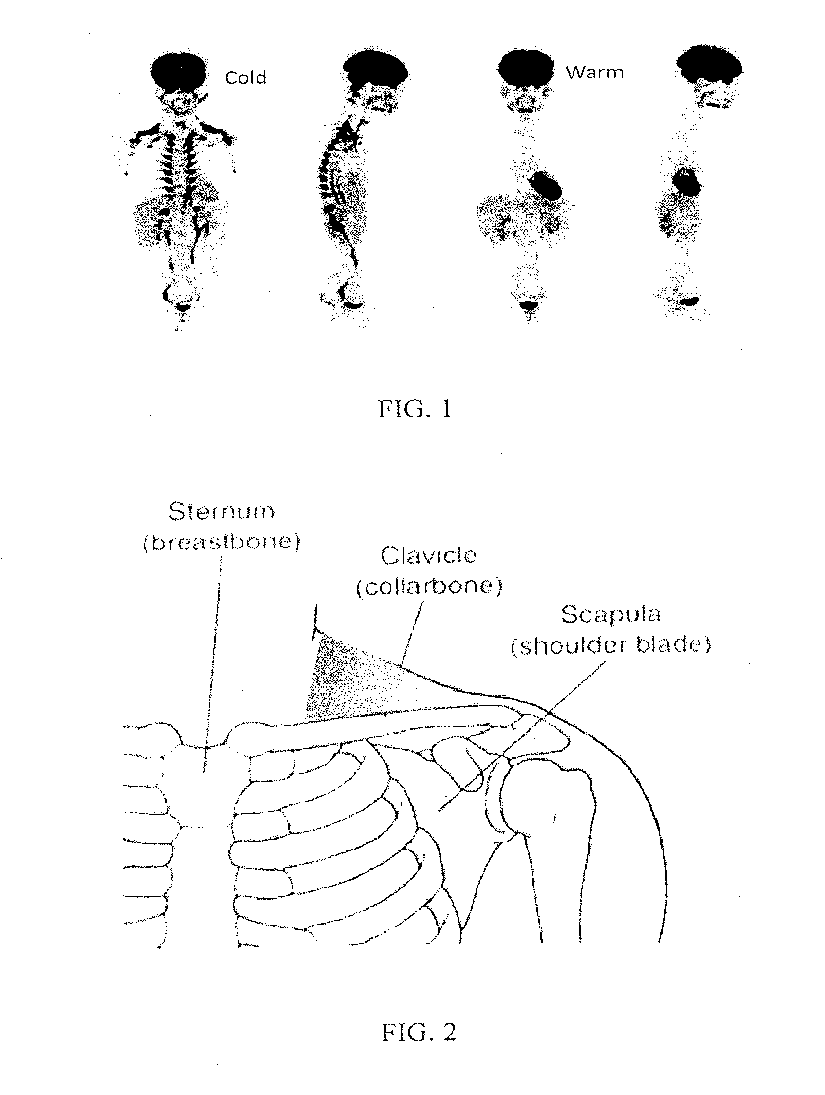Methods and devices for activating brown adipose tissue with cooling