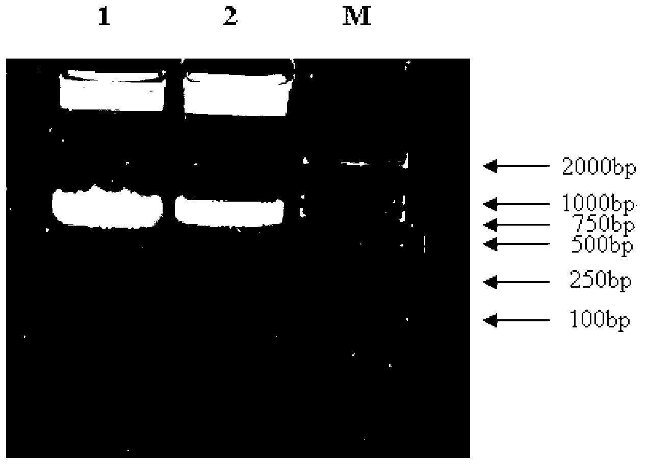 Genetic engineering bacterium expressing snake venom kininogenase as well as constructing method and application thereof