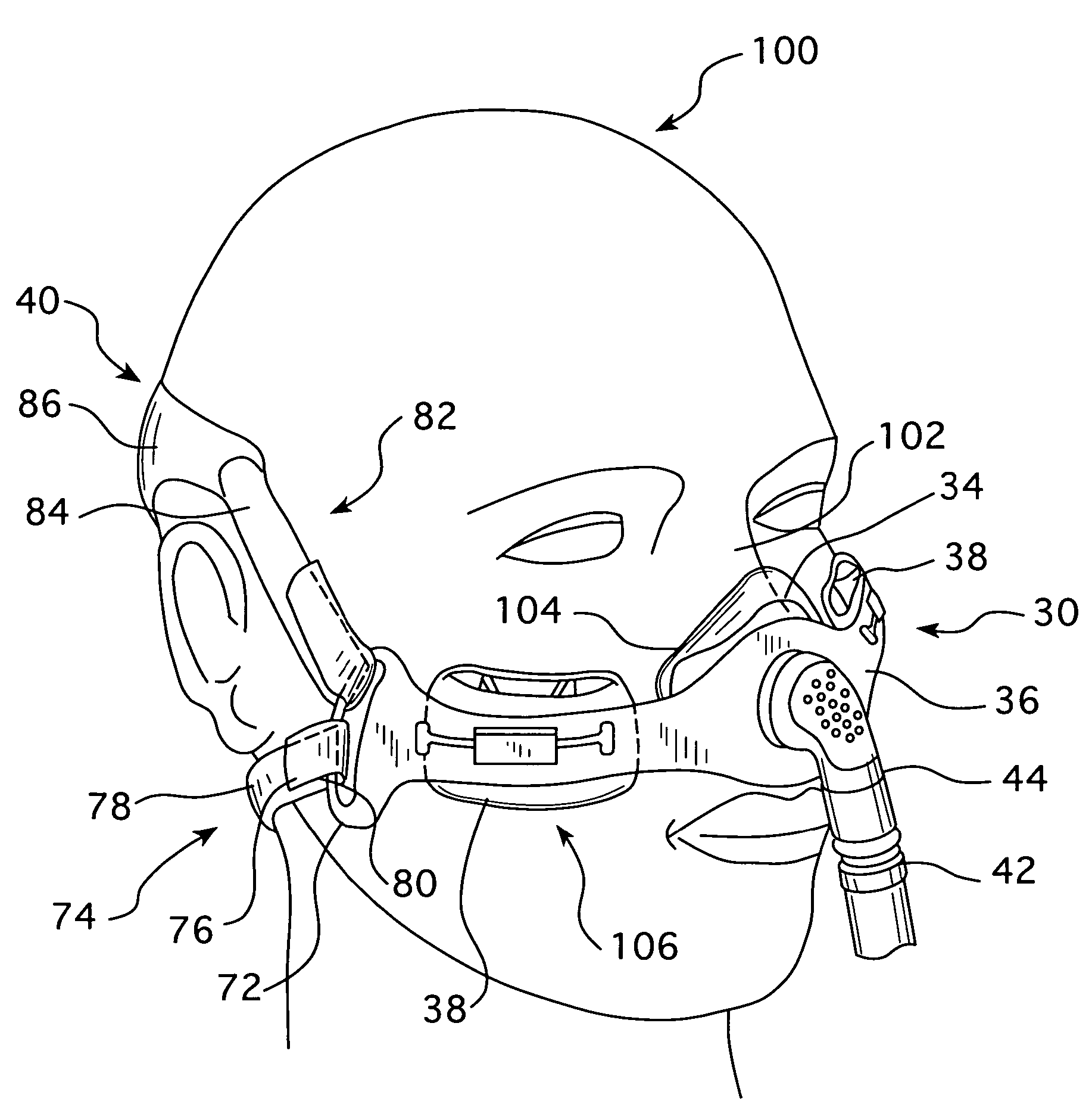 Cheek-mounted patient interface
