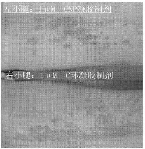 Cnp cyclic peptide, and medicine, external preparation and cosmetic each containing said cyclic peptide