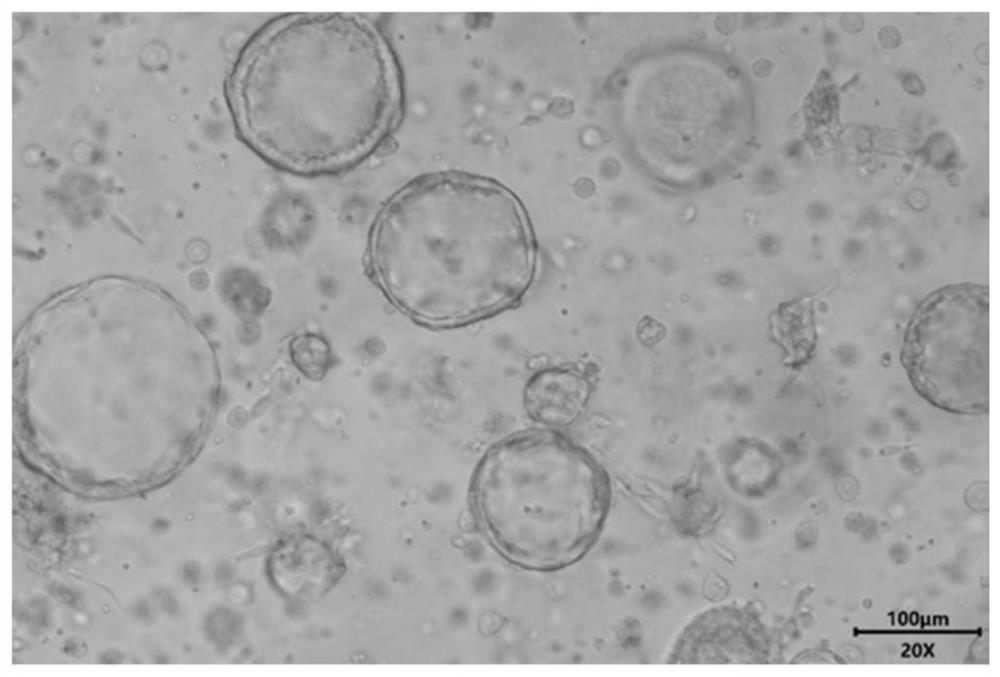 A kind of animal lung bud organoid culture medium and culture method