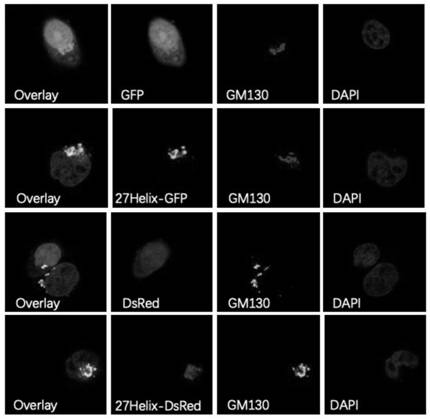 A kind of n-terminal extended type pten subtype ptenζ protein and its coding gene and application