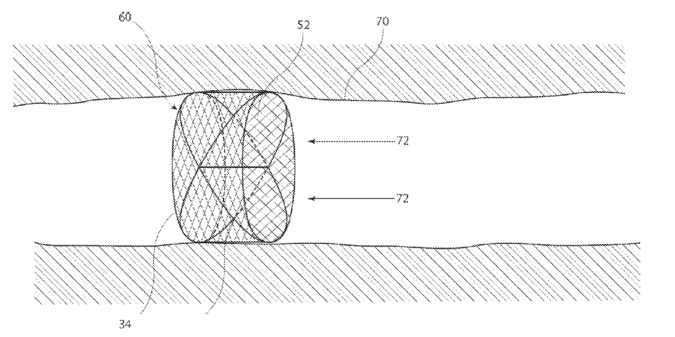 Vascular occluder with crossing frame elements