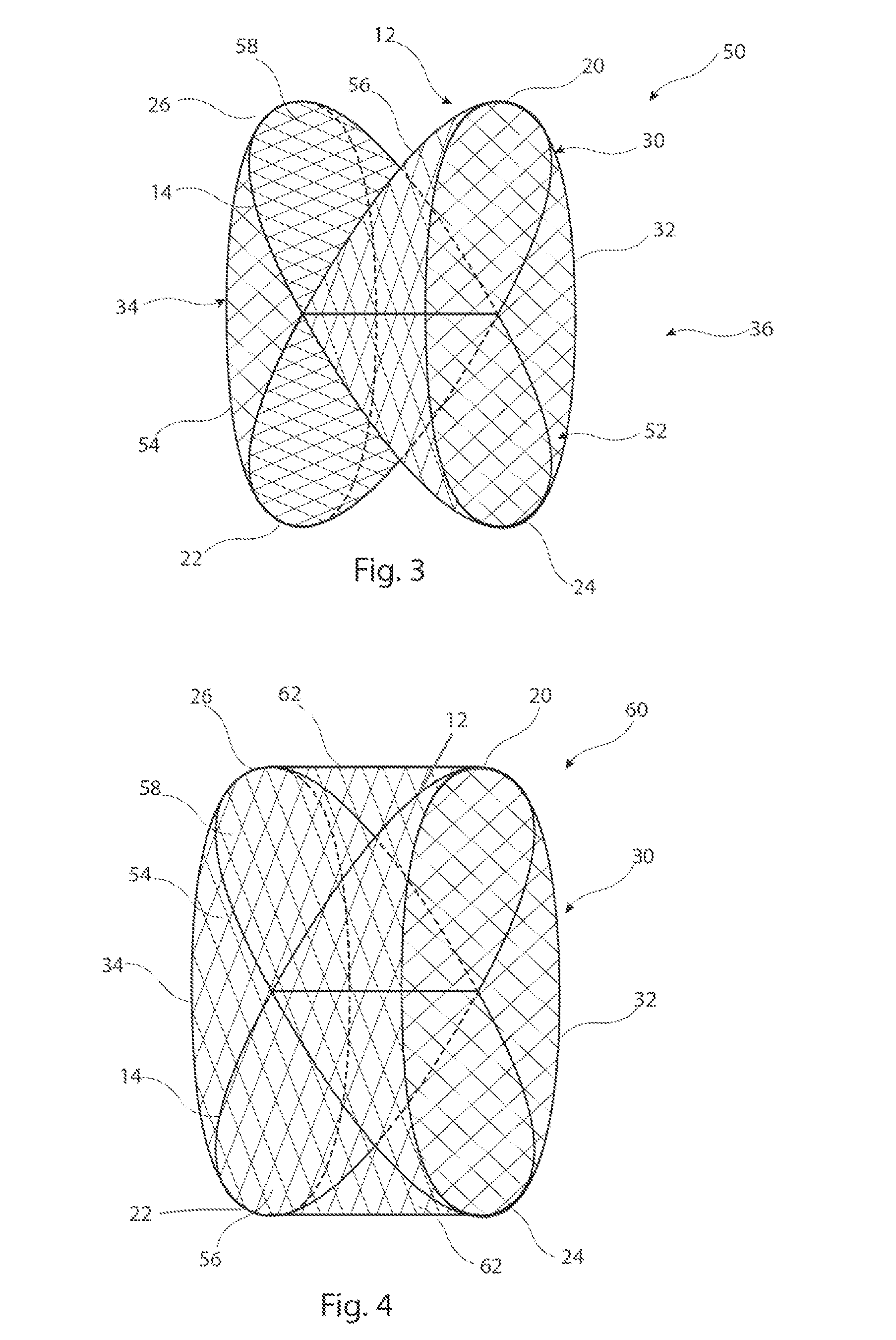 Vascular occluder with crossing frame elements