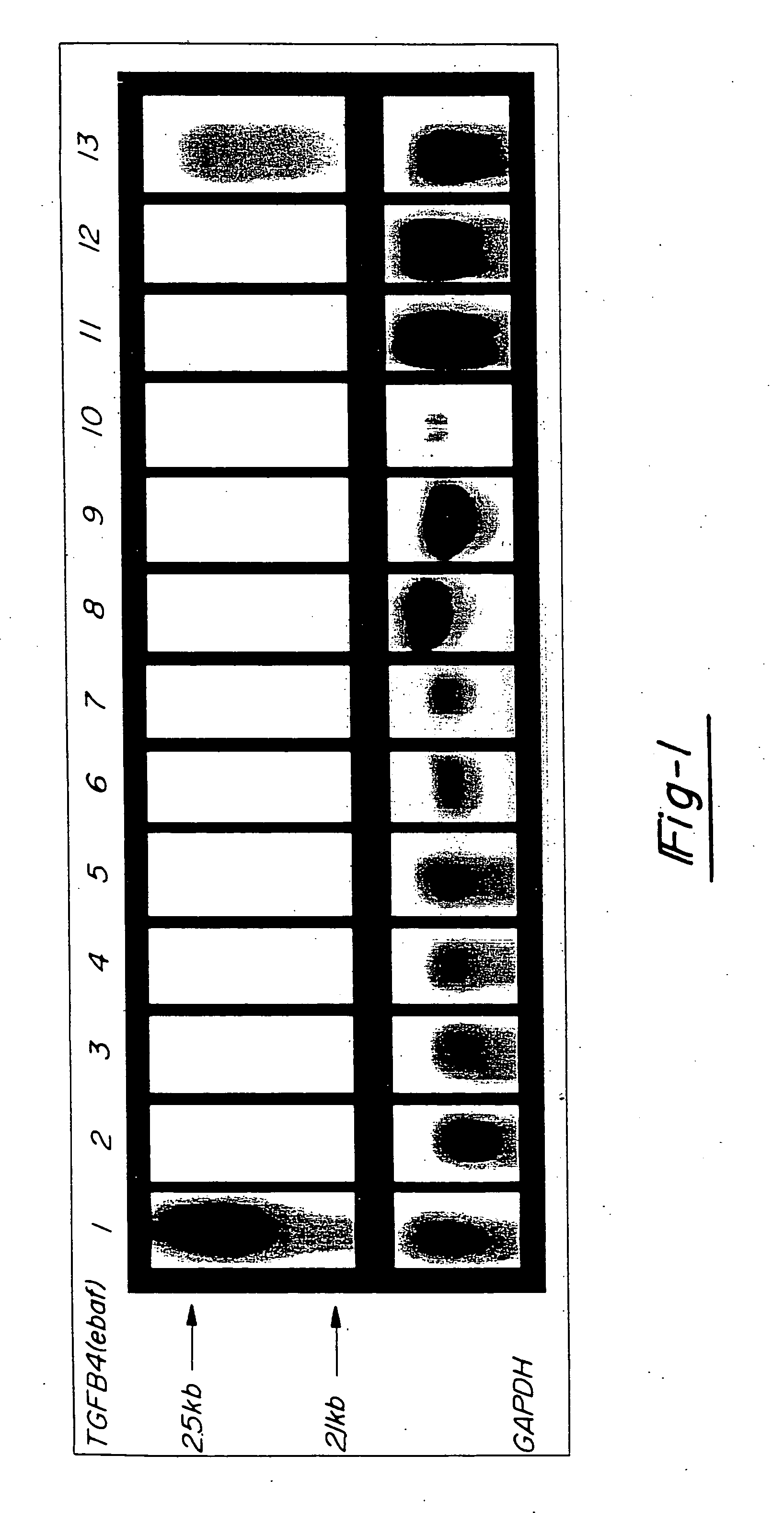 Method for diagnosing selected adenocarcinomas