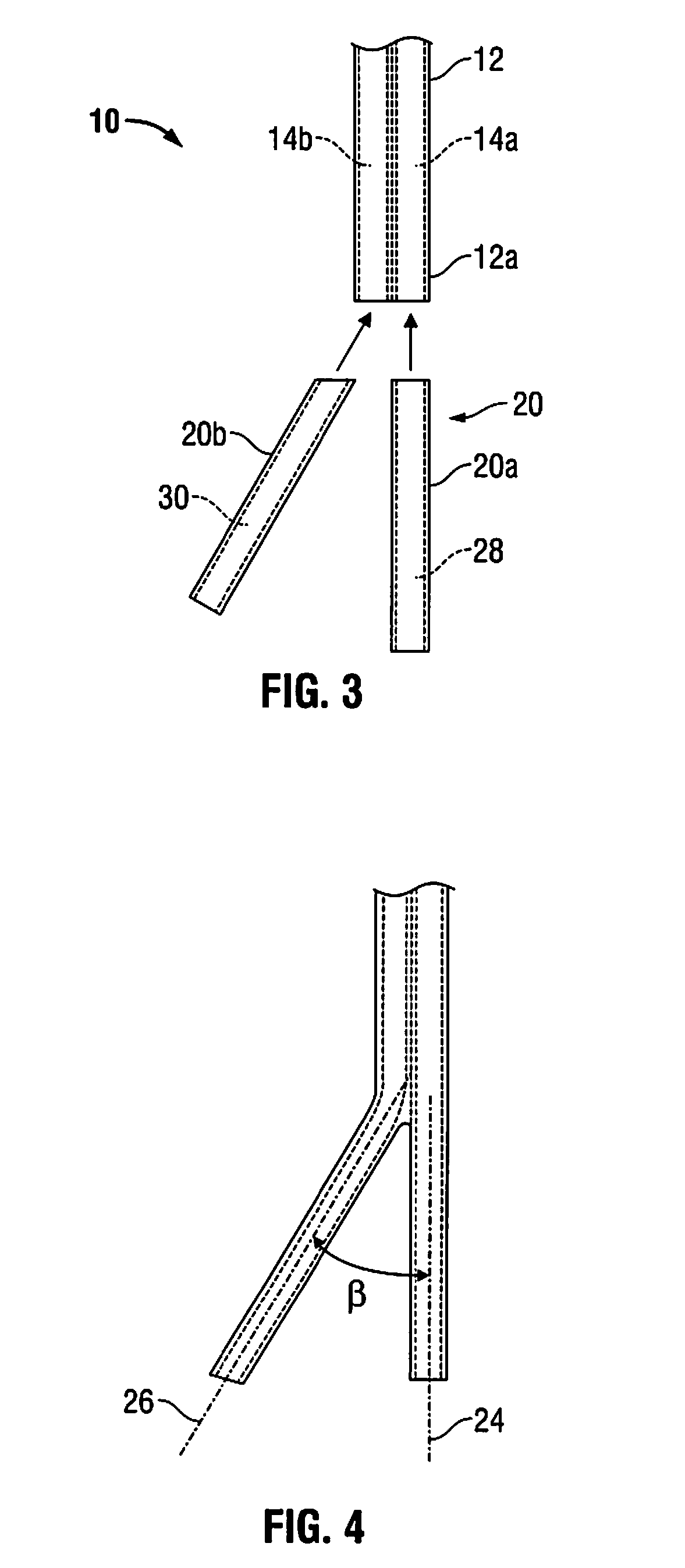 Method for Making a Multi-Lumen Catheter Having a Separated Tip Section