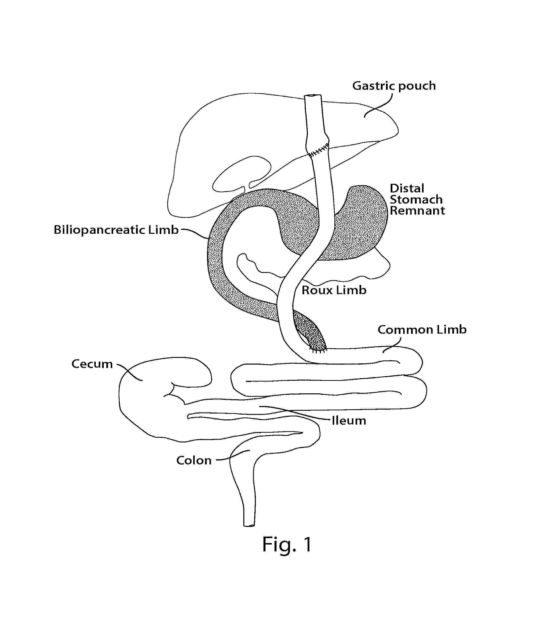 Compositions of microbiota and methods related thereto