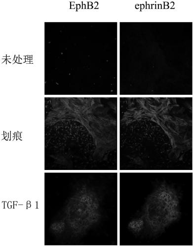 An in vitro glial scar formation model and its construction method and application