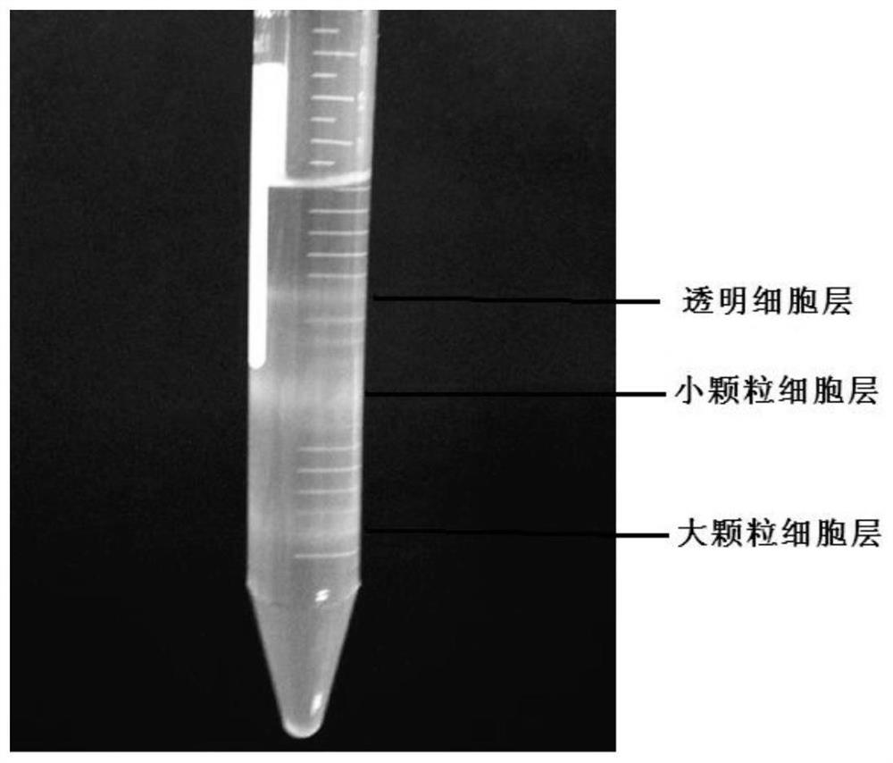 A method for separating blood cells of Portunus trituberculatus