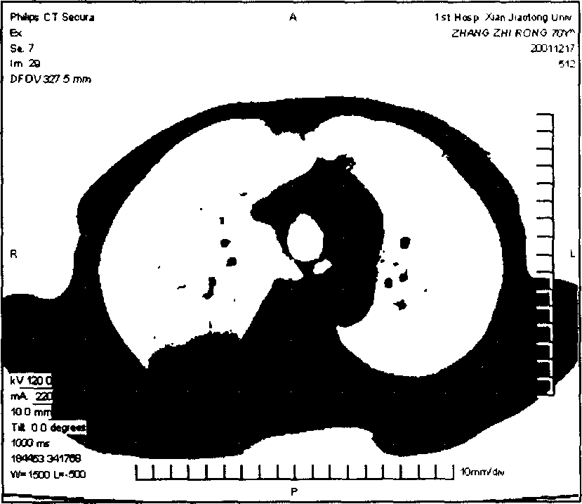 Automatic generating method for colour multi-window CT image