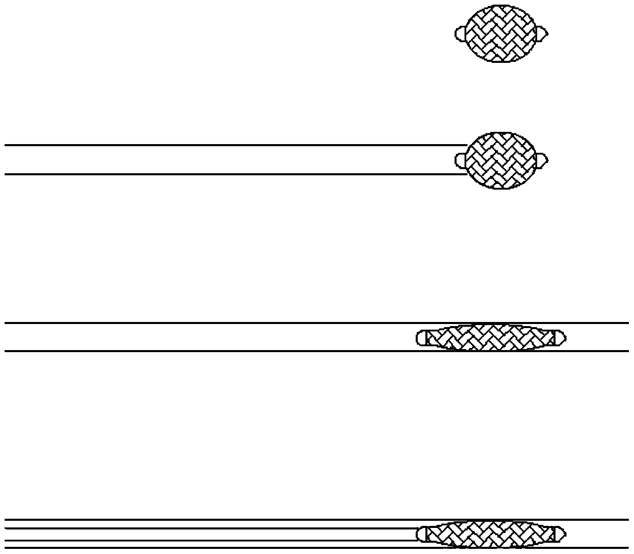 Covered stent, preparation method and weight-losing stent system comprising covered stent
