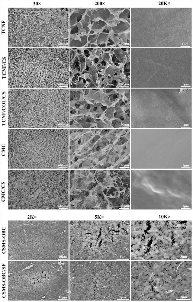 Absorbable hemostasis composite material based on polyanionic cellulose, and preparation method of absorbable hemostasis composite material