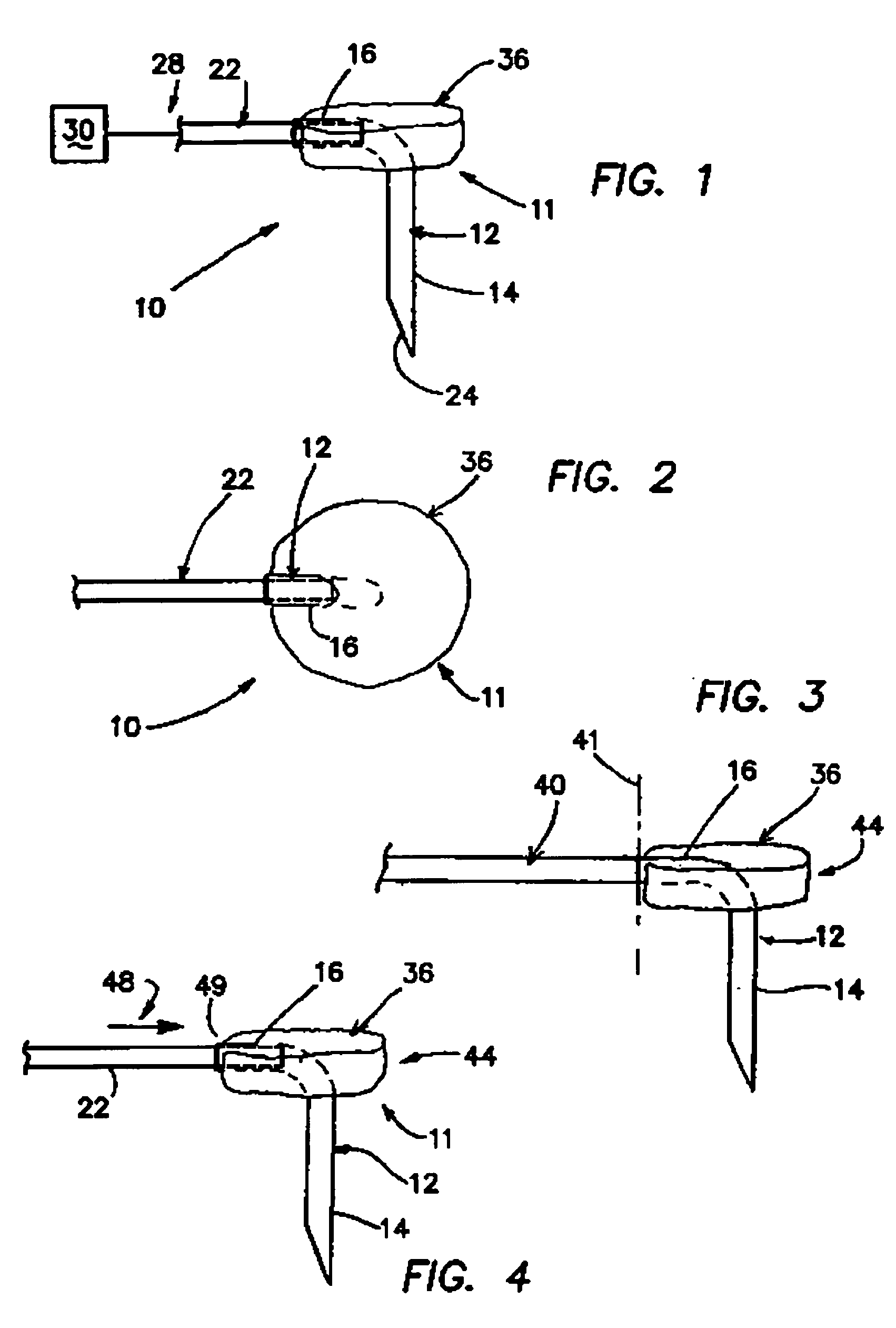 Apparatus and methods useful for monitoring intraocular pressure