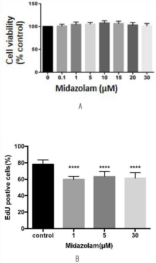 Method for testing influence of midazolam on development of testicular interstitial cells cultured in vitro