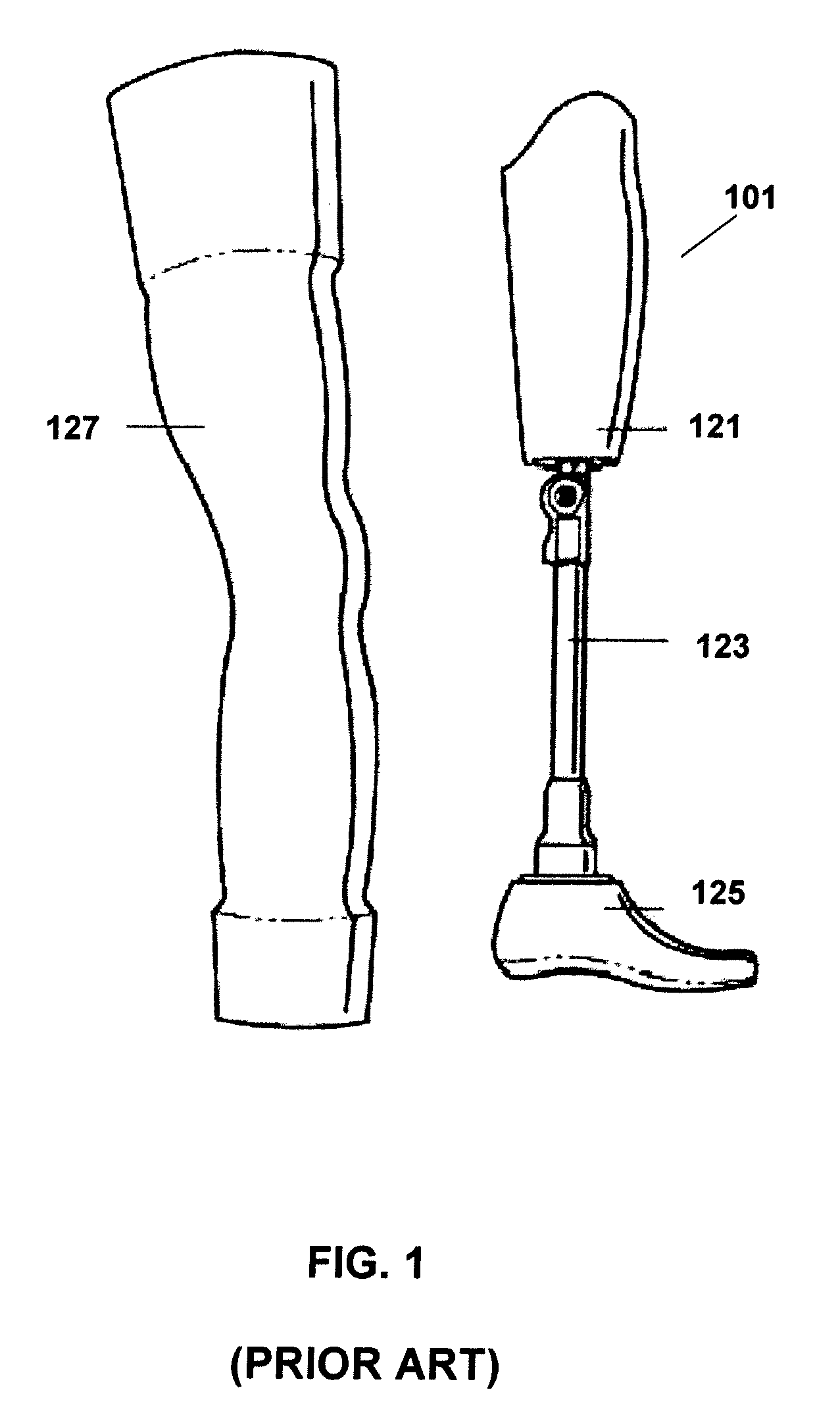 Prosthetic limb