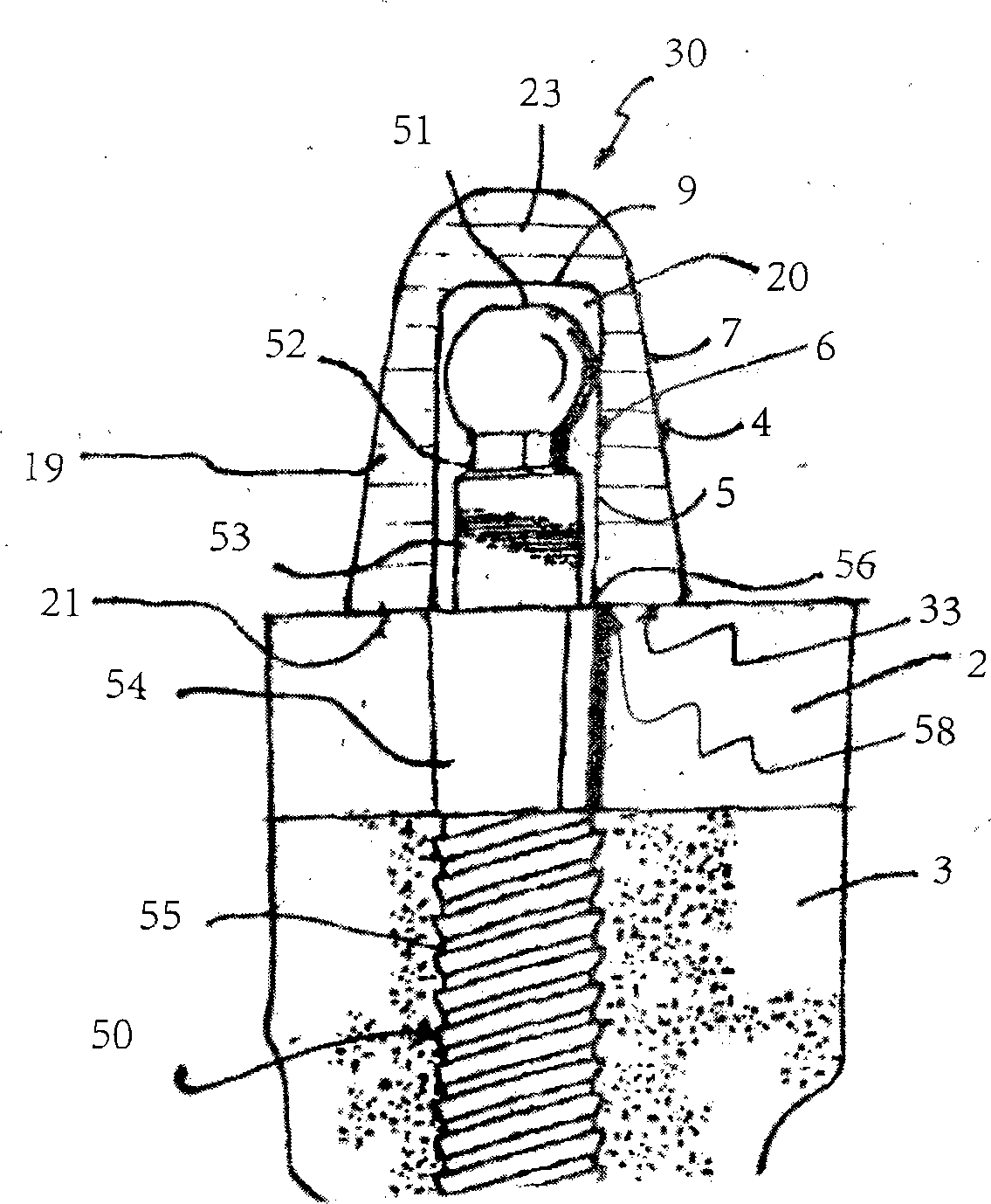 Prosthesis mounting device and carrier tool for use in mini implant fixed/removable prosthodontic applications