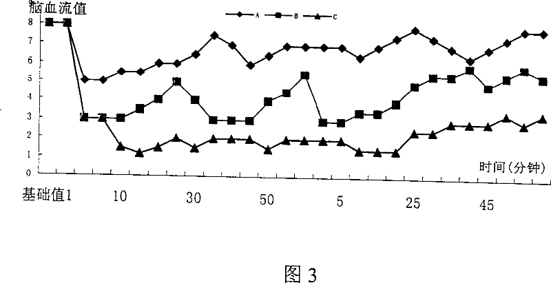 Pharmaceutical preparation ingested via nose for treating ischemia cerebrovascular disease