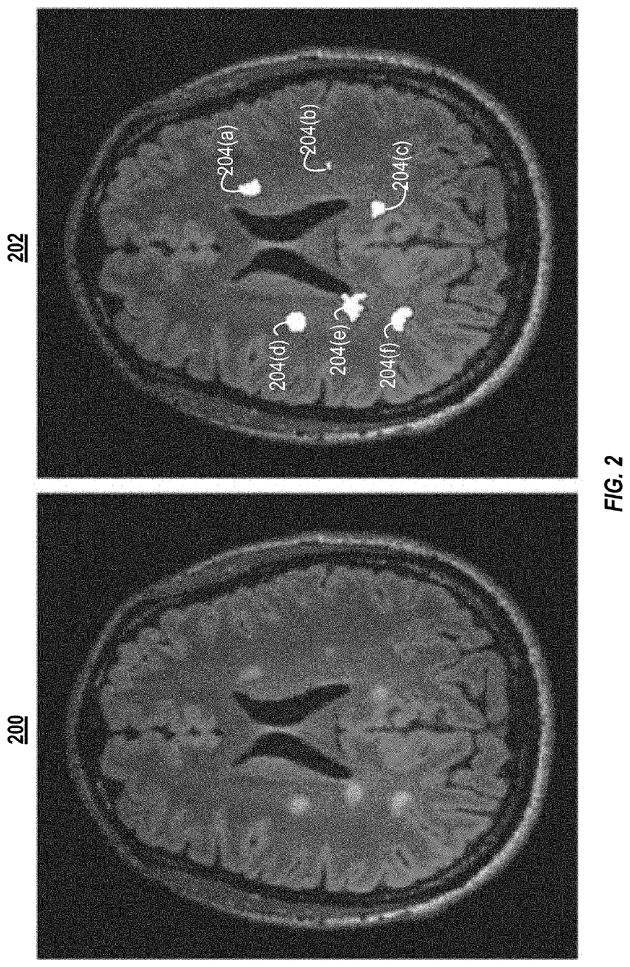 Systems and methods for improved tractography images