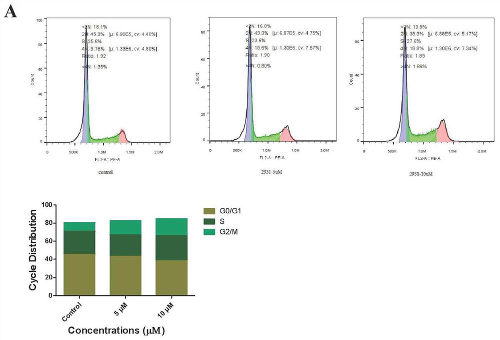 Anticancer peptide DMS-PS1 of South America frog and application thereof