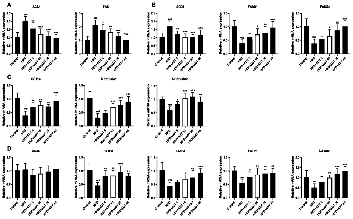 Application of anethol trithione in preparation of medicine for preventing and/or treating toxic fatty acid-caused lipotoxicity of body cells