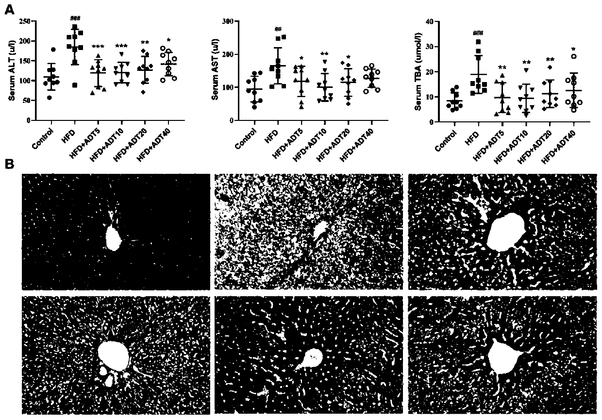 Application of anethol trithione in preparation of medicine for preventing and/or treating toxic fatty acid-caused lipotoxicity of body cells