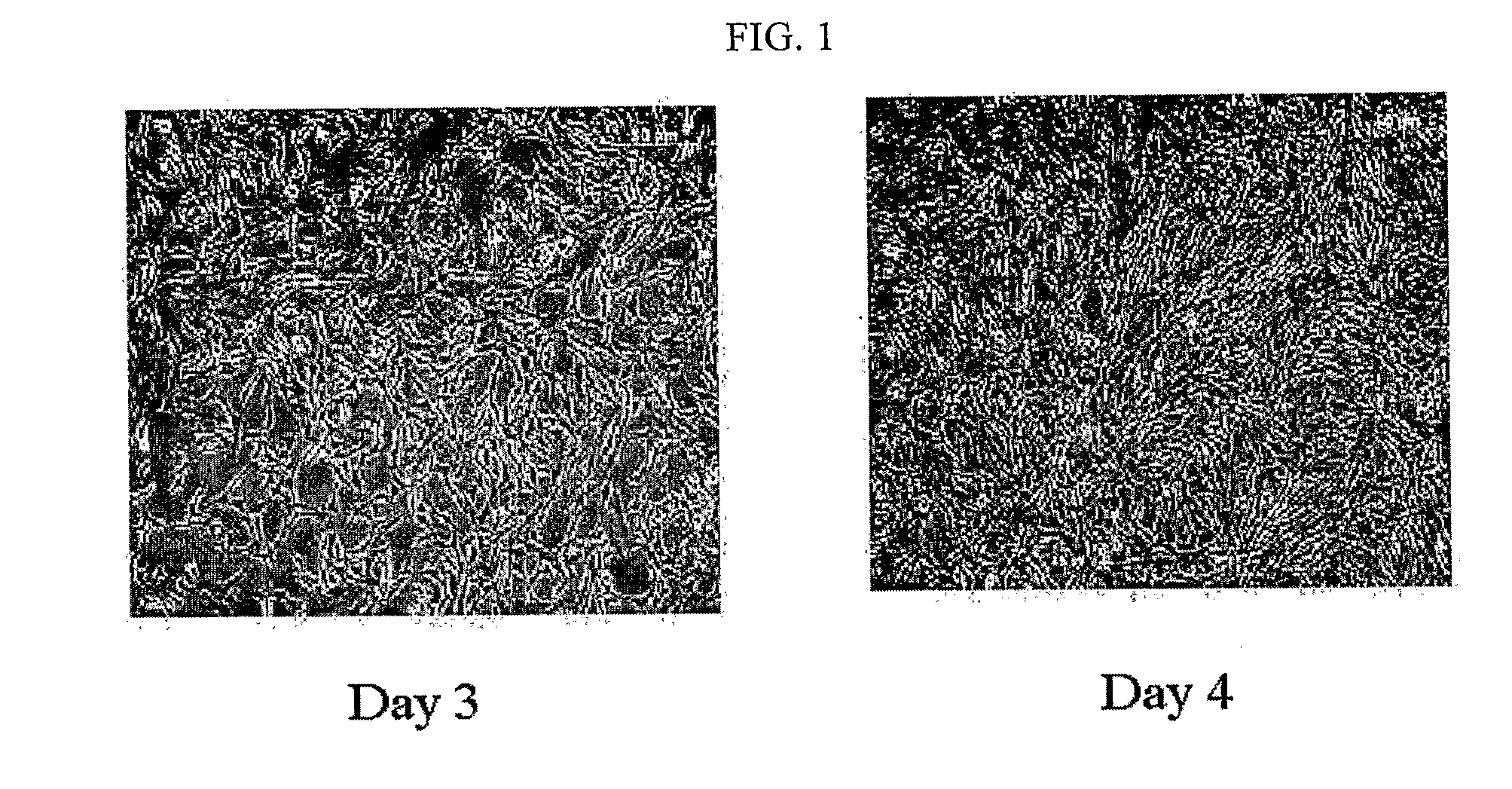 Composition for treating ischemic limb disease comprising stem cells derived from adipose tissue