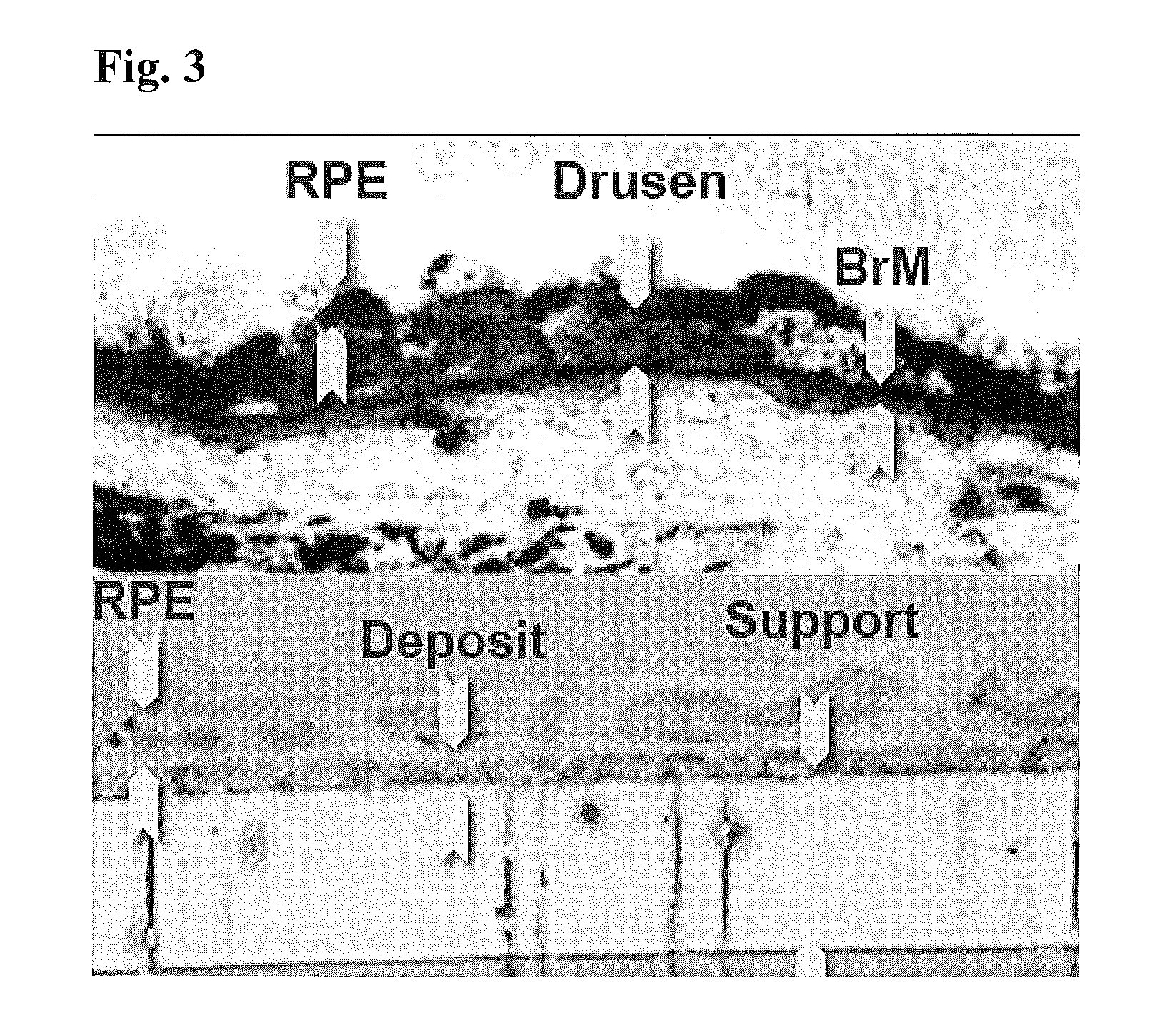 Retinal pigment epithelial primary cell culture system producing subcellular deposits