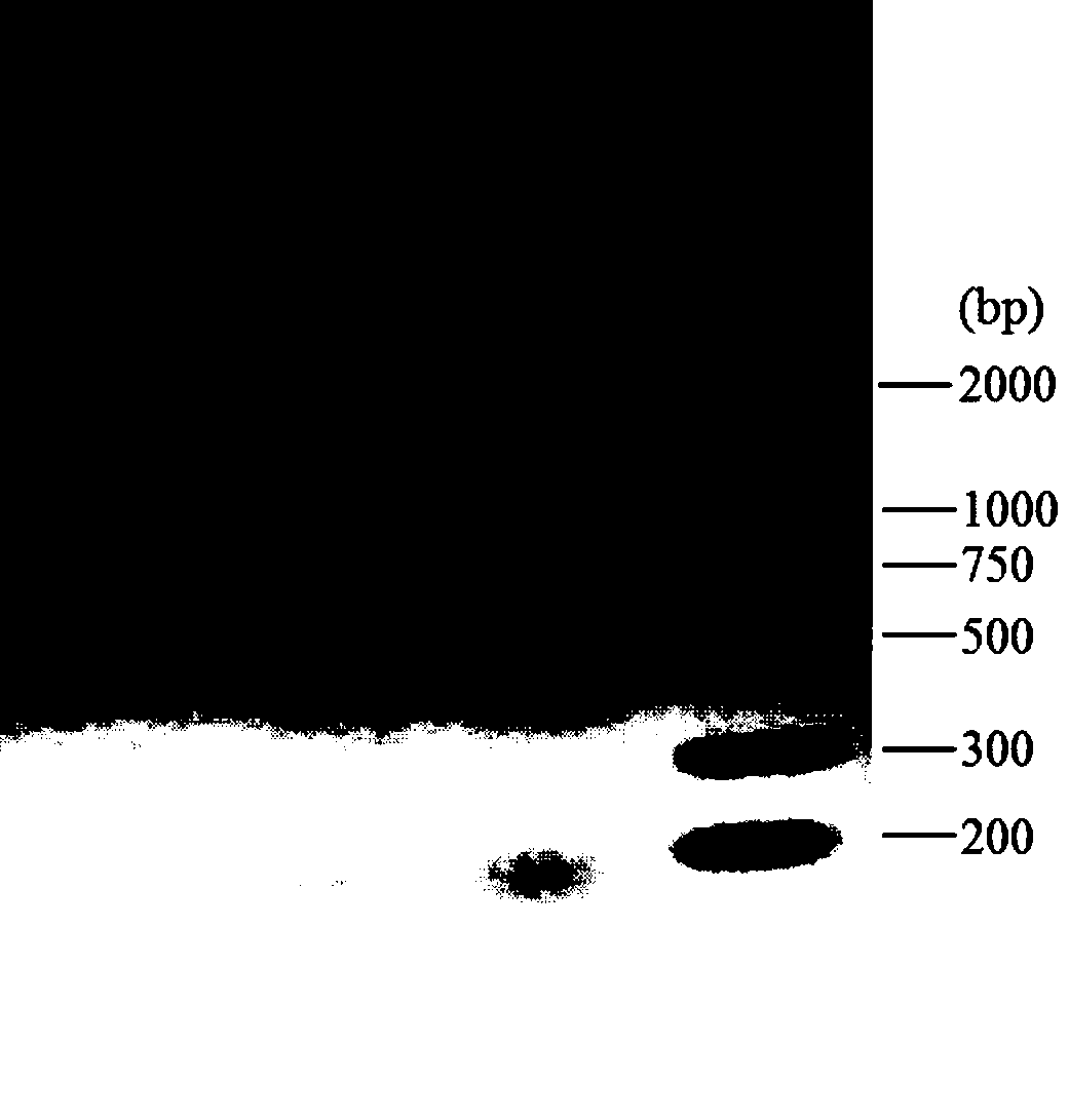 Preparation and application of recombinant adenovirus capable of expressing IL-10