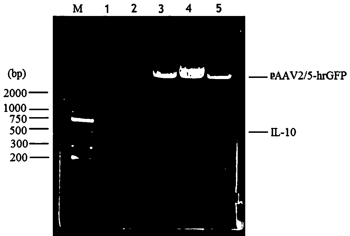 Preparation and application of recombinant adenovirus capable of expressing IL-10