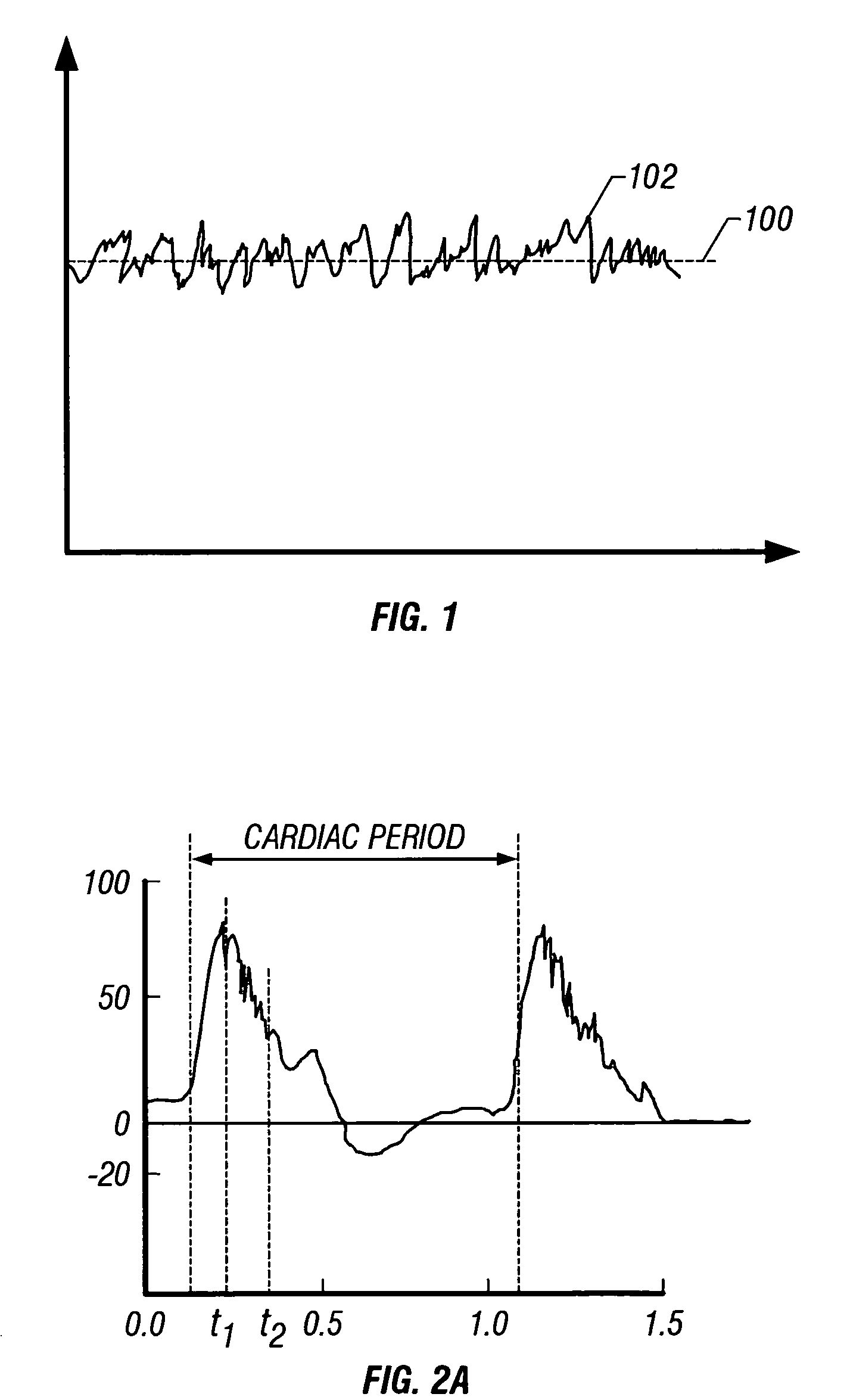 Selective organ cooling apparatus and method